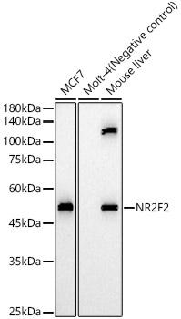 NR2F2 Rabbit Polyclonal Antibody