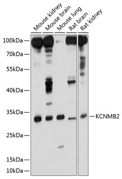 KCNMB2 Rabbit Polyclonal Antibody