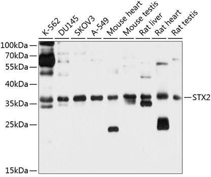 STX2 Rabbit Polyclonal Antibody