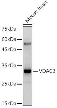VDAC3 Rabbit Polyclonal Antibody