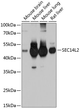 SEC14L2 Rabbit Polyclonal Antibody