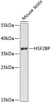 HSF2BP Rabbit Polyclonal Antibody