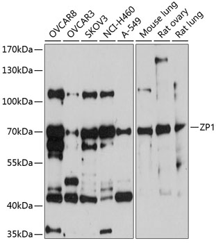 ZP1 Rabbit Polyclonal Antibody