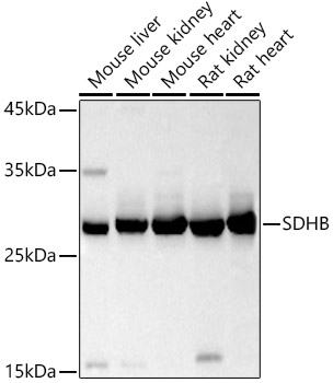 SDHB Rabbit Polyclonal Antibody
