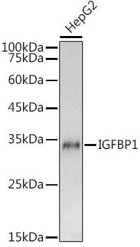 IGFBP1 Rabbit Polyclonal Antibody