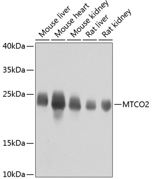 MTCO2 Rabbit Polyclonal Antibody