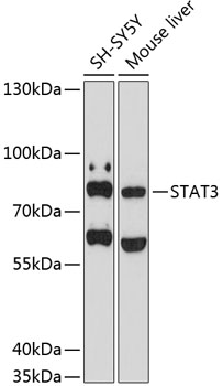 STAT3 Rabbit Polyclonal Antibody