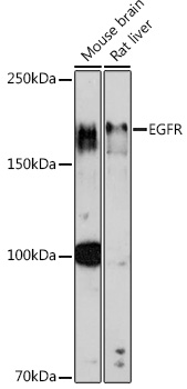 EGFR Rabbit Polyclonal Antibody