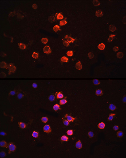 IL1 beta Rabbit Polyclonal Antibody