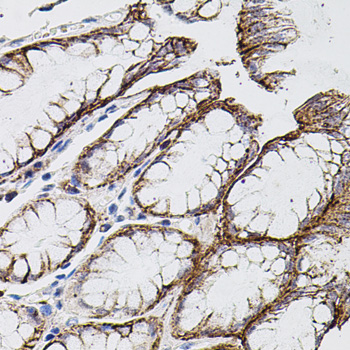 MMP9 Rabbit Polyclonal Antibody