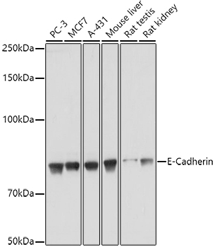 E-Cadherin Rabbit Polyclonal Antibody
