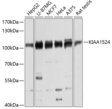 KIAA1524 Rabbit Polyclonal Antibody
