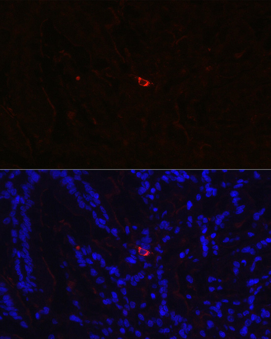 NTS Rabbit Polyclonal Antibody