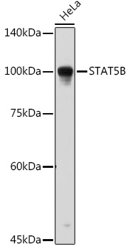 STAT5B Rabbit Polyclonal Antibody