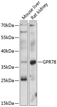 GPR78 Rabbit Polyclonal Antibody