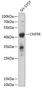 CNTFR Rabbit Polyclonal Antibody