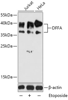 DFFA Rabbit Polyclonal Antibody