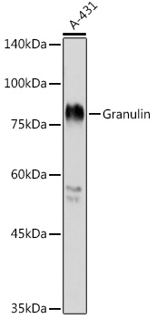 GRN Rabbit Polyclonal Antibody