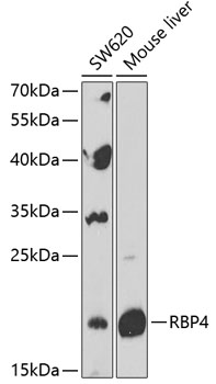 RBP4 Rabbit Polyclonal Antibody