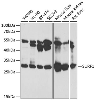 SURF1 Rabbit Polyclonal Antibody