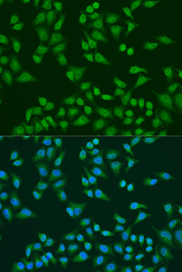 TIA1 Rabbit Polyclonal Antibody