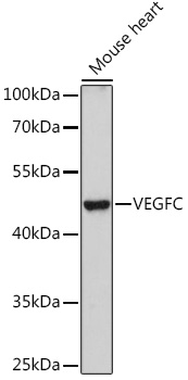 VEGFC Rabbit Polyclonal Antibody