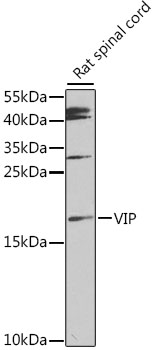 VIP Rabbit Polyclonal Antibody