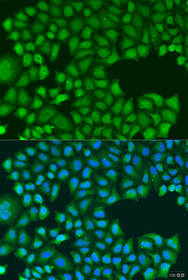 TIRAP Rabbit Polyclonal Antibody