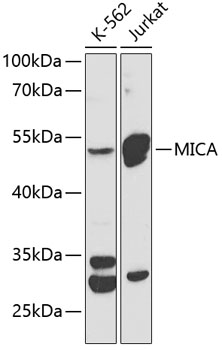 MICA Rabbit Polyclonal Antibody