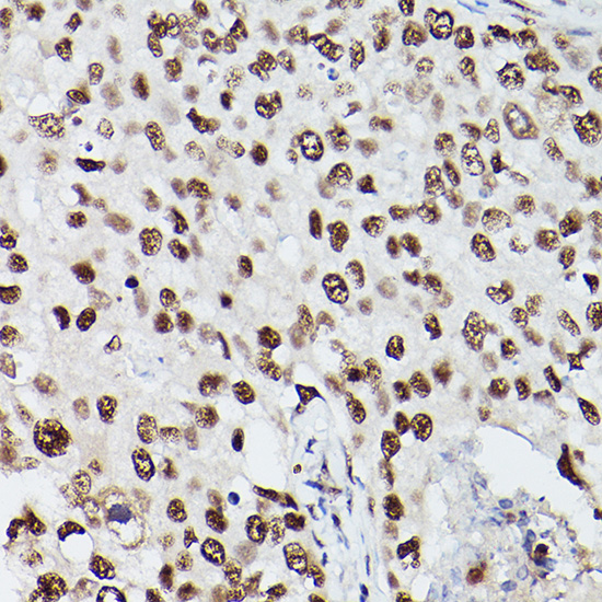 PSME3 Rabbit Polyclonal Antibody