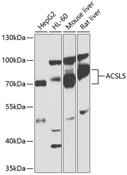 ACSL5 Rabbit Polyclonal Antibody
