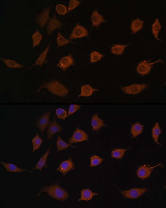 LSM1 Rabbit Polyclonal Antibody