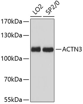 ACTN3 Rabbit Polyclonal Antibody