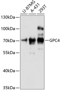 GPC4 Rabbit Polyclonal Antibody