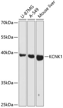 KCNK1 Rabbit Polyclonal Antibody