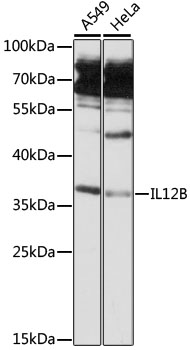 IL12B Rabbit Polyclonal Antibody