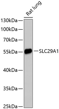 SLC29A1 Rabbit Polyclonal Antibody