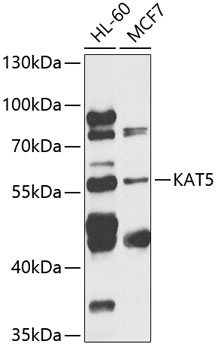 KAT5 Rabbit Polyclonal Antibody