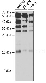 CST1 Rabbit Polyclonal Antibody