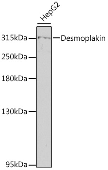 Desmoplakin Rabbit Polyclonal Antibody