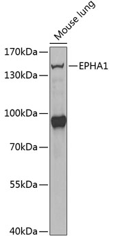 EPHA1 Rabbit Polyclonal Antibody