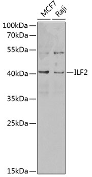 ILF2 Rabbit Polyclonal Antibody