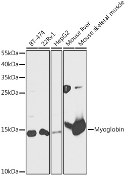 MB Rabbit Polyclonal Antibody