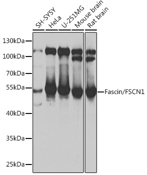FSCN1 Rabbit Polyclonal Antibody