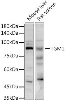 TGM1 Rabbit Polyclonal Antibody