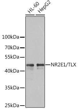 NR2E1 Rabbit Polyclonal Antibody