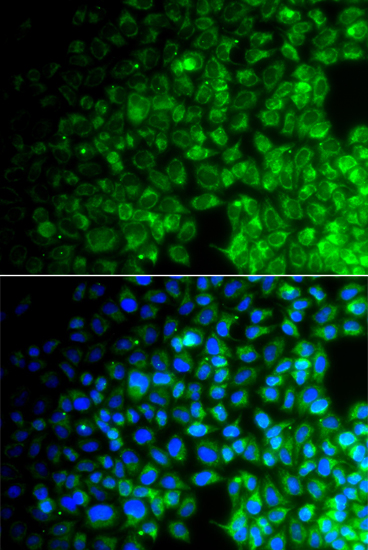 USP10 Rabbit Polyclonal Antibody