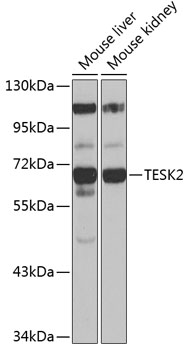 TESK2 Rabbit Polyclonal Antibody
