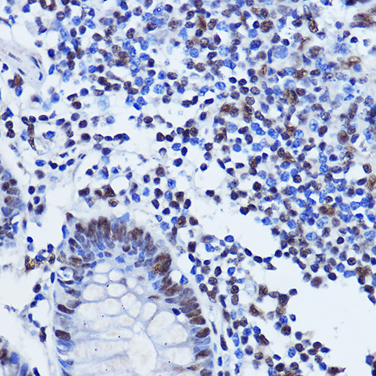 TARDBP Rabbit Polyclonal Antibody