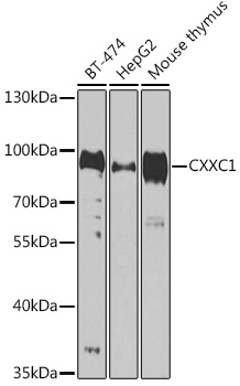 CXXC1 Rabbit Polyclonal Antibody